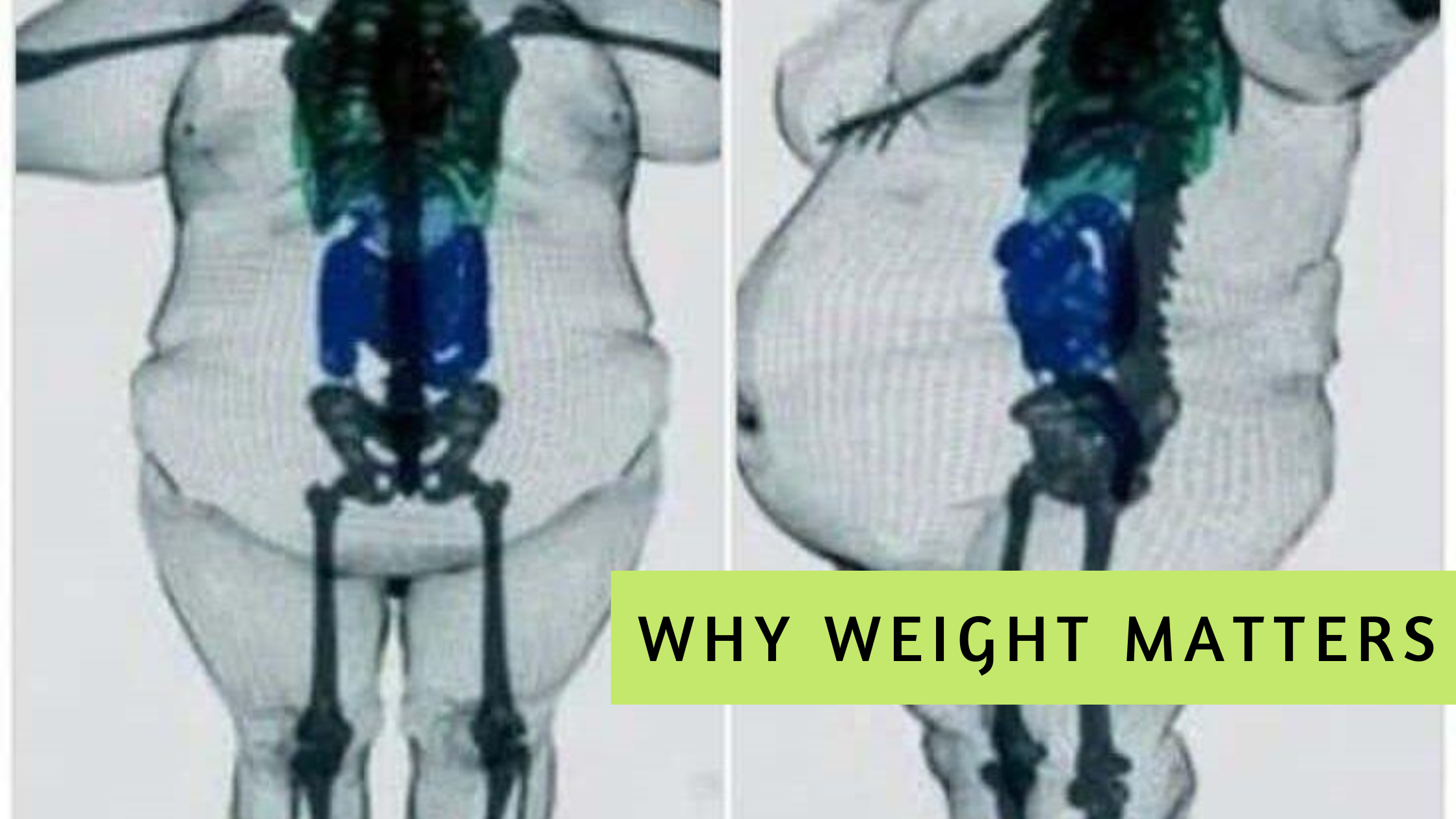 Why weight matters - Not just on the scale, but inside your body